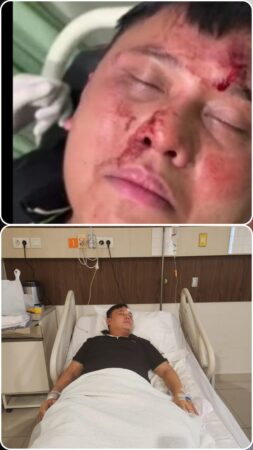 Dedy Gunawan, Dianiaya dan Disekap di Hotel Grand Central Premier : Hendra Koh Diduga Owner Hiburan Club malam Amavi di Medan Dilaporkan ke Polda Sumut