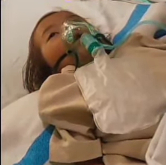 Raya meninggal secara tragis di Kabupaten Sukabumi akibat infestasi cacing parah. Prof. Sutan Nasomal mengecam kelalaian aparatur desa setelah tragedi balita di Sukabumi meninggal akibat infestasi cacing.